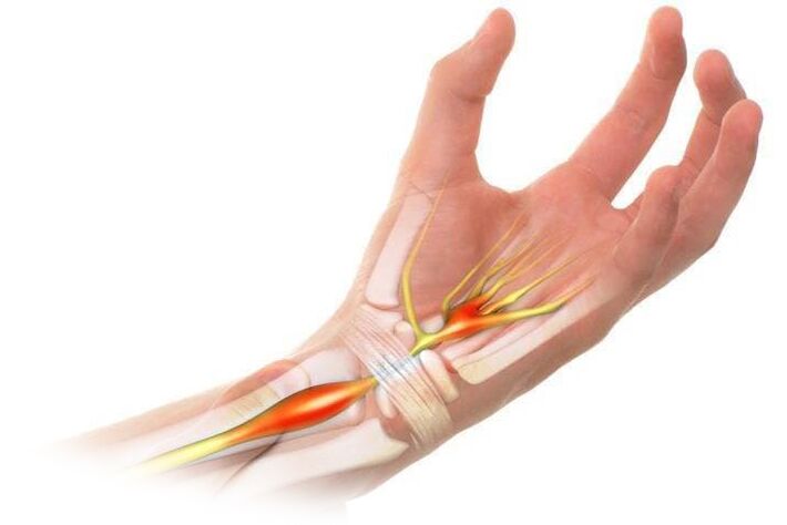 Pain with inflammation of the joints