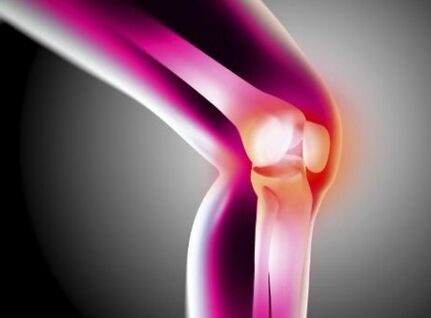 Summarize arthrosis