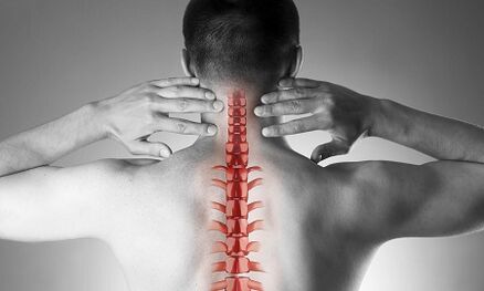 How cervical spinal osteochondrosis is shown on its own