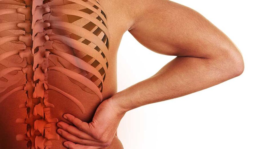 Lumbar spinal osteochondrosis