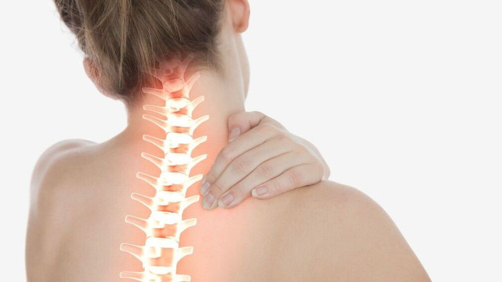 Neck pain due to cervical spine osteochondrosis